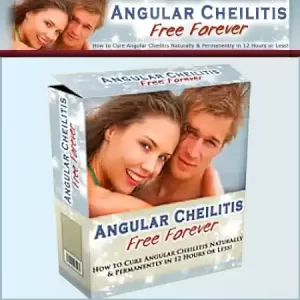 Angular Cheilitis Free Forever