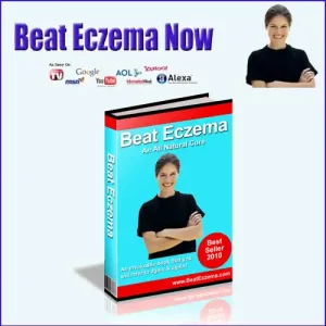 Beat Eczema Now